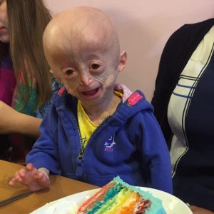 la malattia di Lucy parke